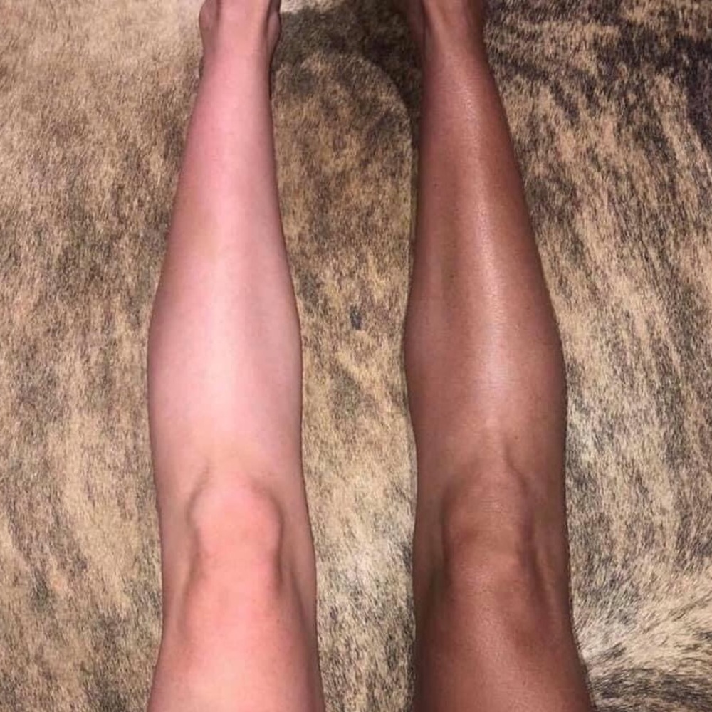 Self tanner